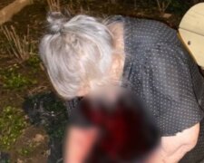 Украинец зверски избил пожилую мать, женщину нашли под подъездом: "Переломы носа и..."