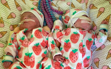Дети размером с ладошку: в Перинатальном центре Киева удалось выходить двойняшек, которые родились весом 560 и 570 грамм