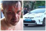 В Одесі розбірки завершилися стріляниною, серед поранених дитина: кадри з місця